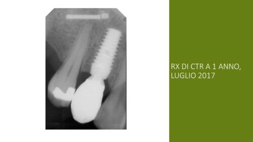 DellaTorre-M.-Conical Grade-Diapositiva12