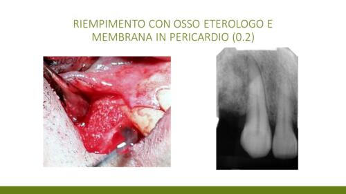 DellaTorre-M.-Conical Grade-Diapositiva5