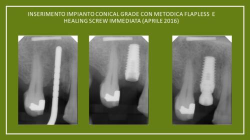 DellaTorre-M.-Conical Grade-Diapositiva7