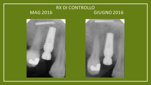 DellaTorre-M.-Conical Grade-Diapositiva8