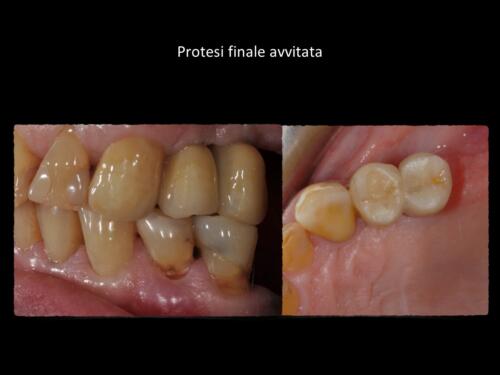 Messina-M. Conical-Grade-Diapositiva4